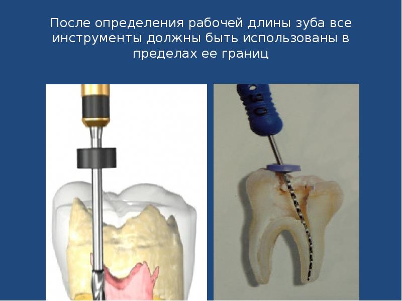 После определения