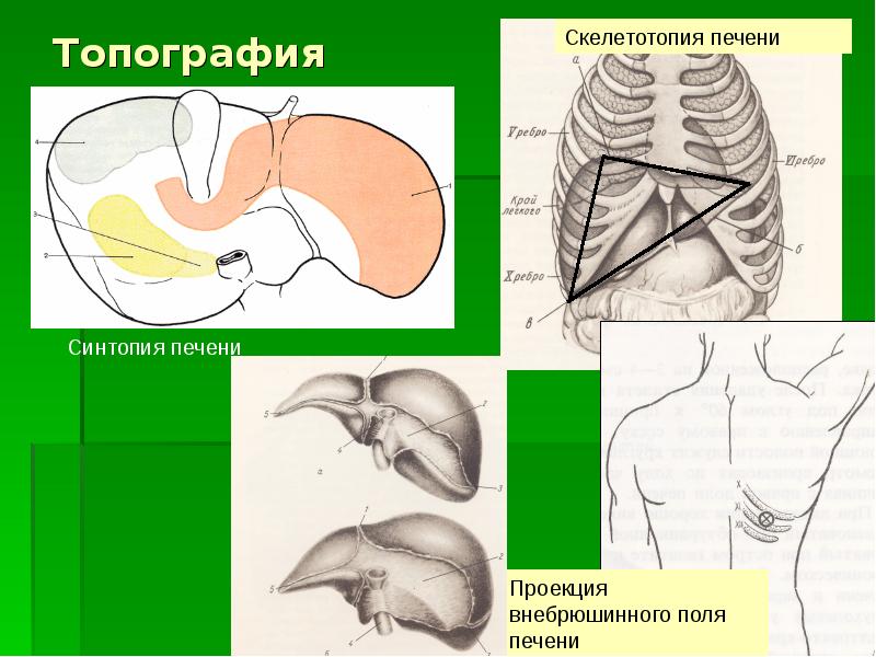 Нарисовать топографические области передней брюшной стенки