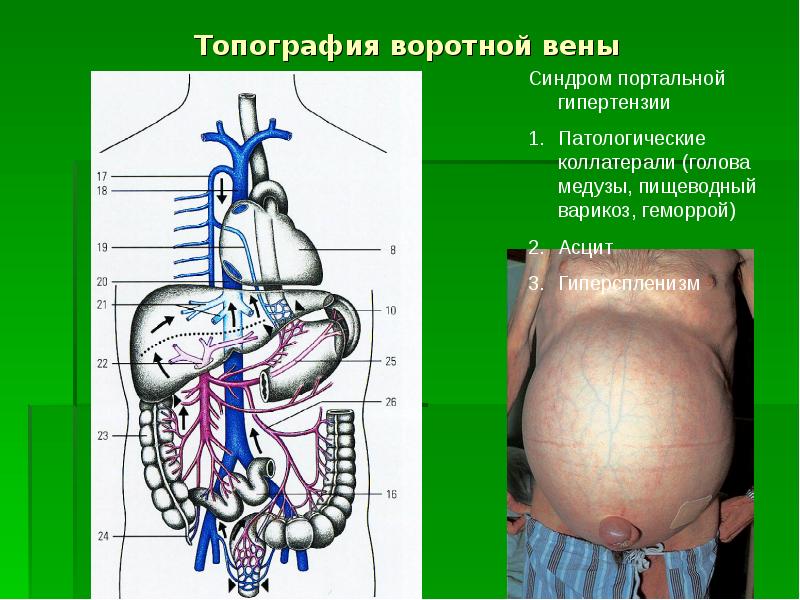 Анатомия брюшной полости человека в картинках