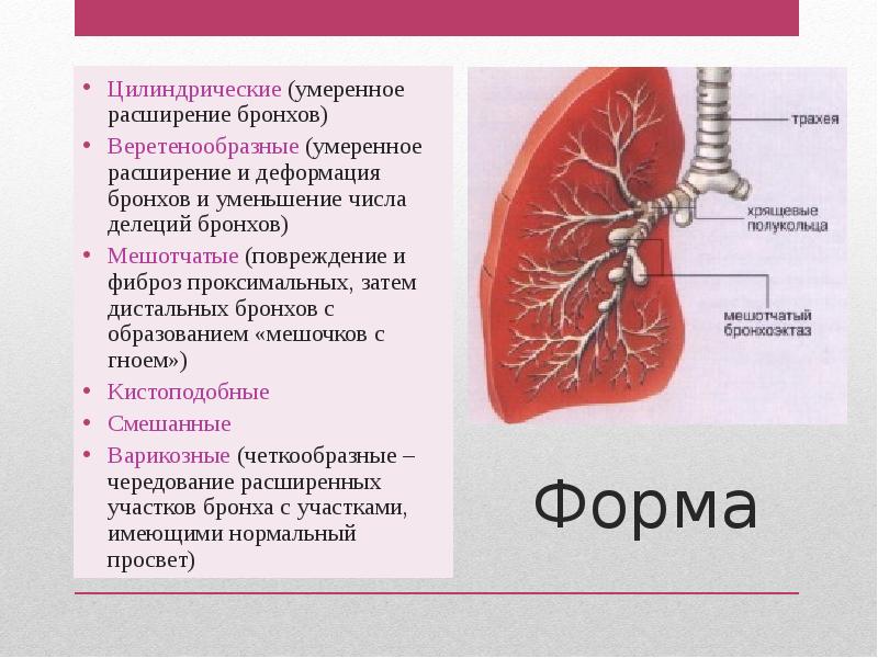 Слюнокаменная болезнь презентация