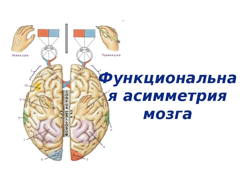 Асимметрия мозга презентация