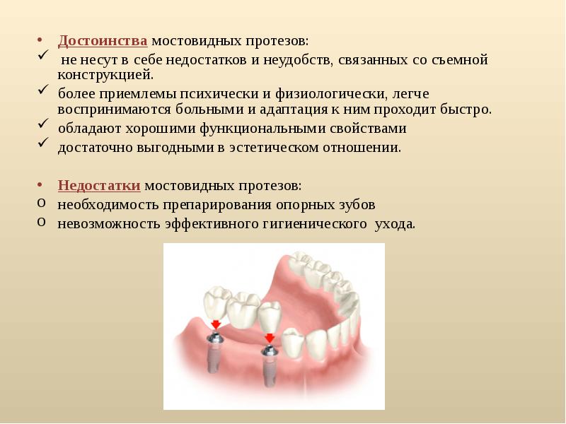 Съемные ортопедические конструкции презентация