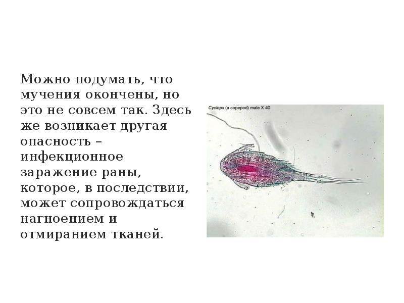 Ришта дракункулез фото