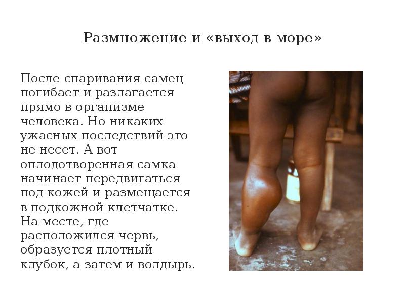 Размножение и «выход в море»
После спаривания самец погибает и разлагается Размножение и «выход в море»
После спаривания самец погибает и разлагается
