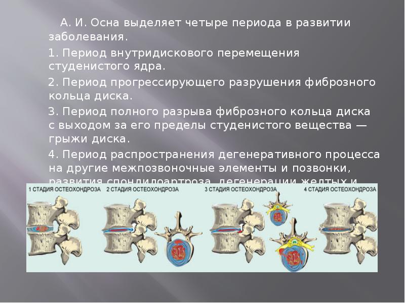 А. И. Осна выделяет четыре периода в развитии заболевания.
А. И. Осна выделяет четыре периода в развитии заболевания.