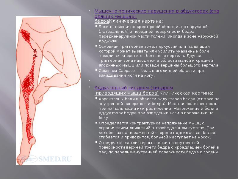 Мышечно-тонические нарушения в абдукторах (отводящих мышцах) бедраКлиническая картина:
Мышечно-тонические нарушения в Мышечно-тонические нарушения в абдукторах (отводящих мышцах) бедраКлиническая картина:
Мышечно-тонические нарушения в