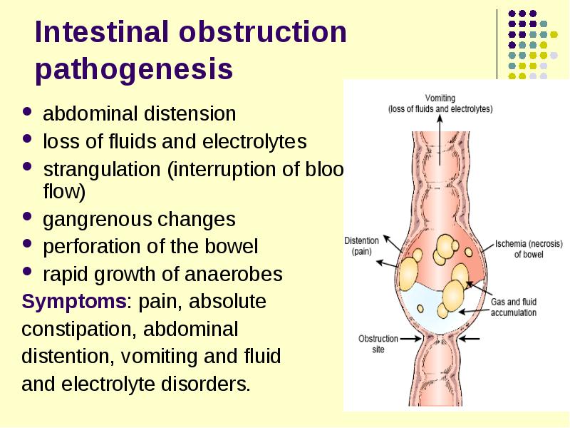 Distension abdominal