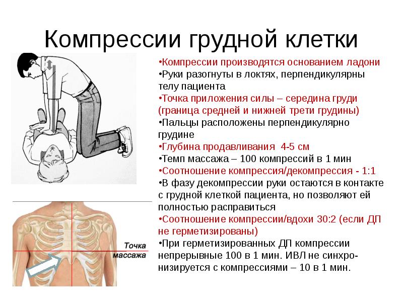 Проект на тему сердечно легочная реанимация