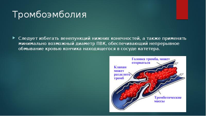 Тромбоэмболия артерий конечностей. Профилактика тромбоэмболии. Тромбоэмболия нижних конечностей. Воздушная эмболия осложнения.