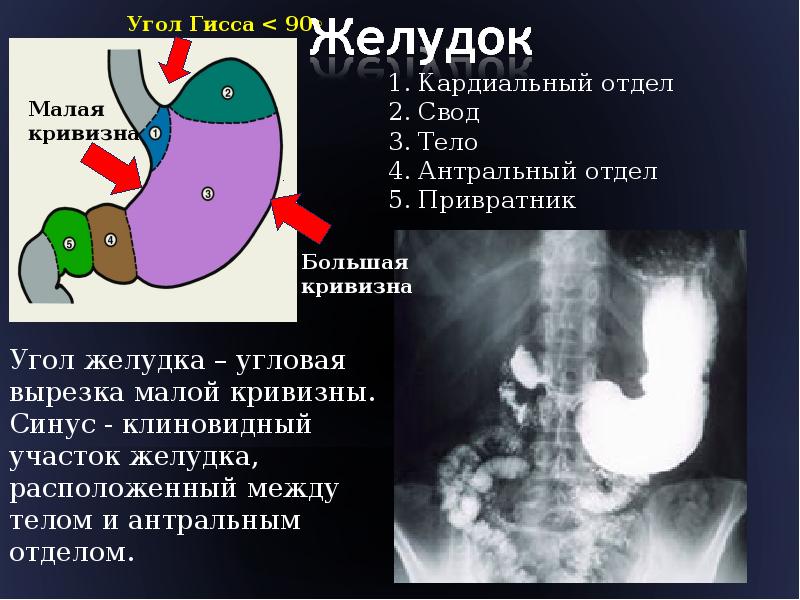 Антральный отдел желудка где находится фото