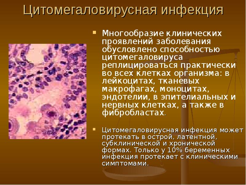 Доклад: Цитомегаловирусная инфекция