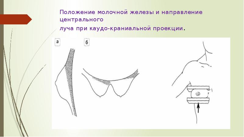 Положение груди. Положение молочной железы. Молочные железы проекции. Гальванизация молочных желез. Гальванизация на молочные железы.