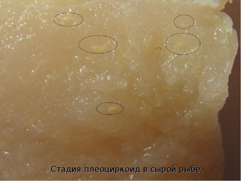 Описторхоз яйца в кале фото