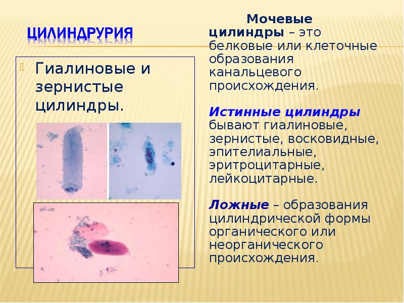 Гиалиновые цилиндры