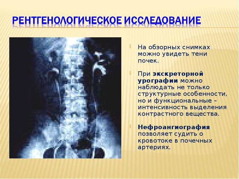 Лучевая семиотика заболеваний органов мочевыделительной системы презентация