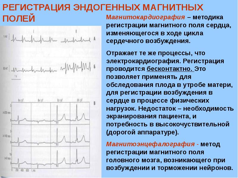 Добудьте фрагменты доказательства и создайте теорему чертежа системы лимбо