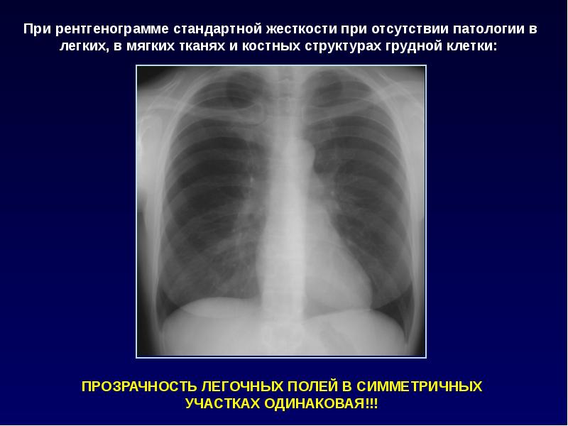 Реферат: Рентгенологические синдромы