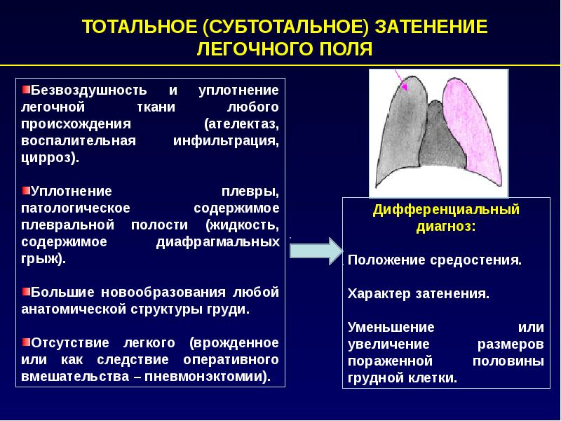 Ателектаз легкого презентация