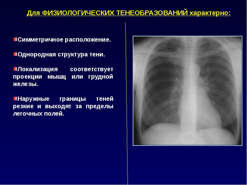 Реферат: Рентгенологические синдромы