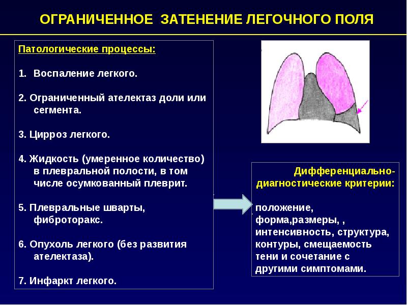 Стадии плеврита