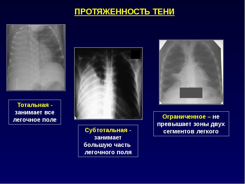  Foto 33