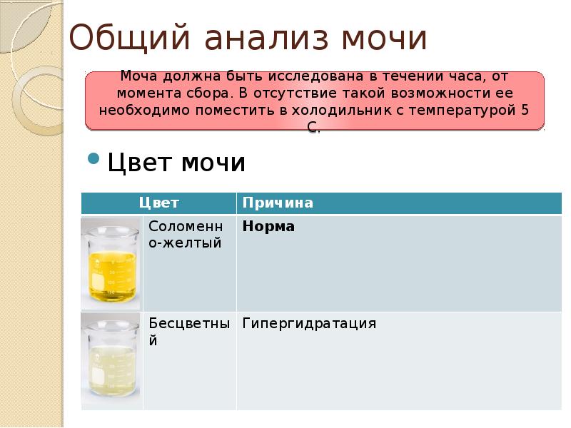 Какого цвета должна быть моча у человека