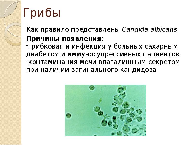 Семиотика урологических заболеваний презентация