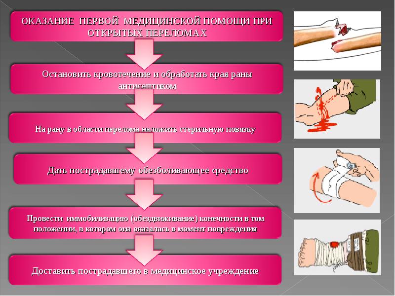 Первая помощь при травмах практическое занятие обж 8 класс презентация