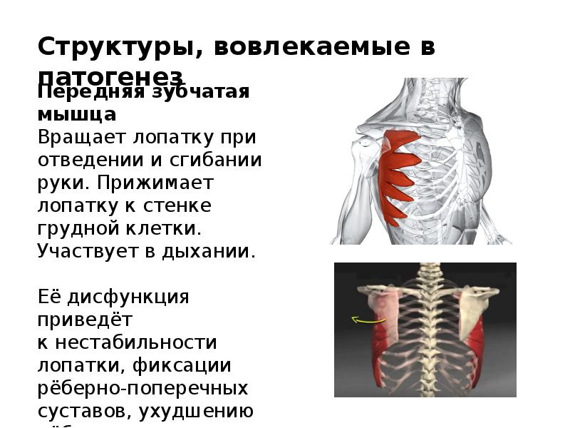 Мышца поднимающая лопатку. Мышцы вращающие лопатку. Плечелопаточный периартрит формулировка диагноза. Нестабильность лопатки. Мышцы лопаток поднятая рука.