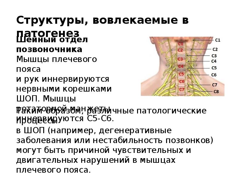 Плечелопаточный периартрит шифр. Лопаточно-плечевой периартрит. Плечелопаточный периартроз патогенез. Двусторонний плечелопаточный периартрит что это. Плечелопаточный периартрит мкб 10.