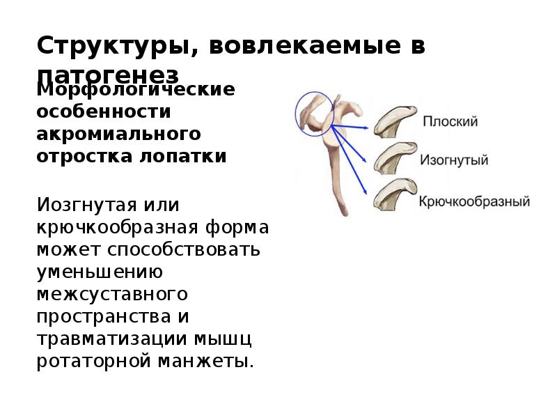 Периартрит плечевого сустава