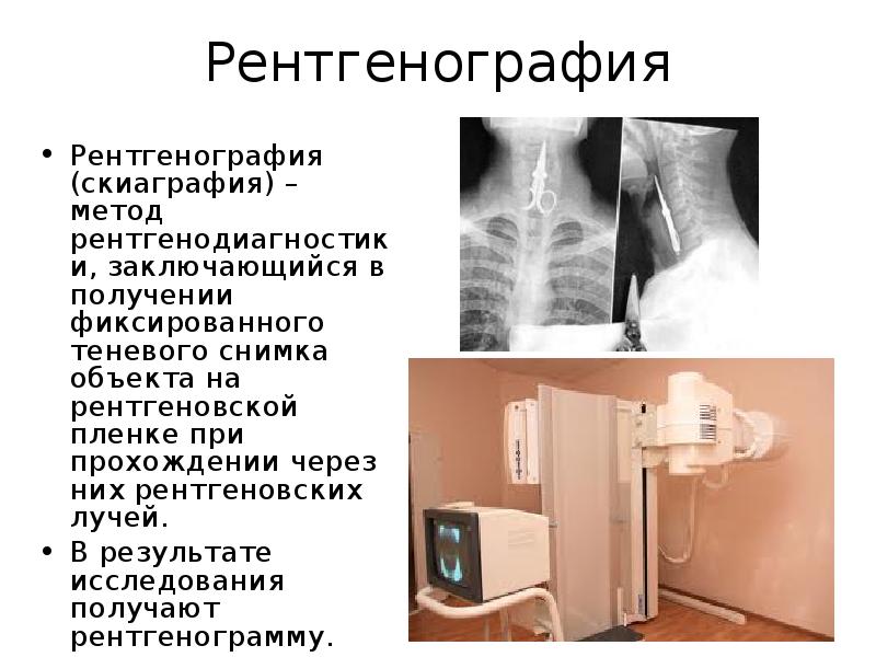 Рентгеновское изображение получается в результате