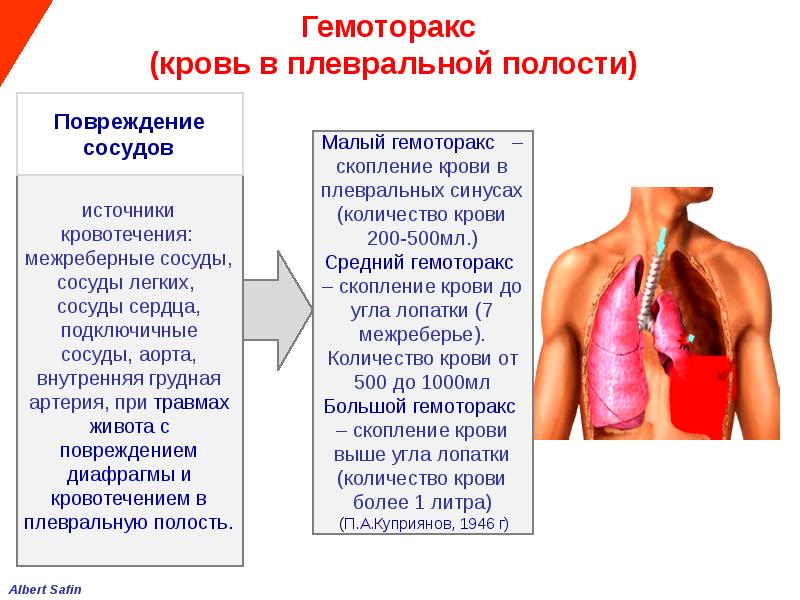 Презентация на тему травмы грудной клетки