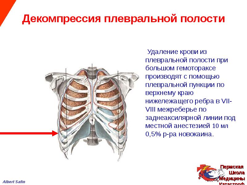 Травма груди презентация