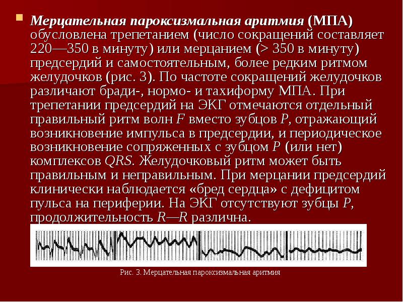 Мерцательная аритмия презентация