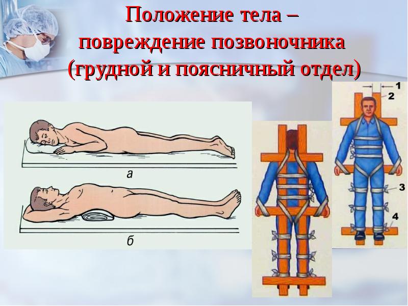 Покажите на муляже иммобилизацию в кровати при помощи связок