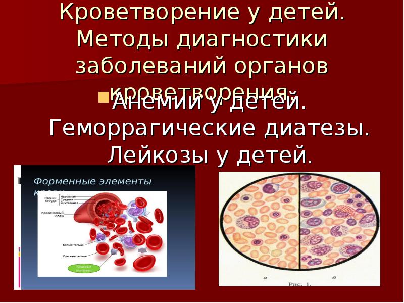 Реферат по теме Терапия (анемии, тромбоцитопеническая пурпура, гемофилия)