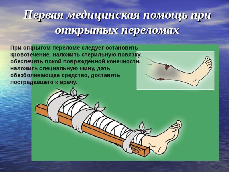 Первая помощь при бытовых травмах картинки