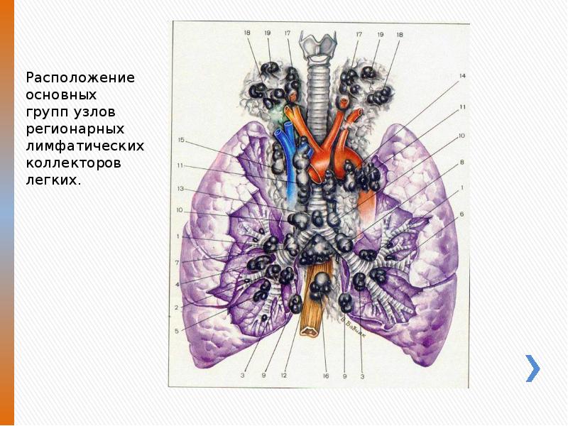 Лимфоузлы легких схема