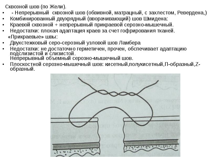 Кишечные швы топографическая анатомия презентация