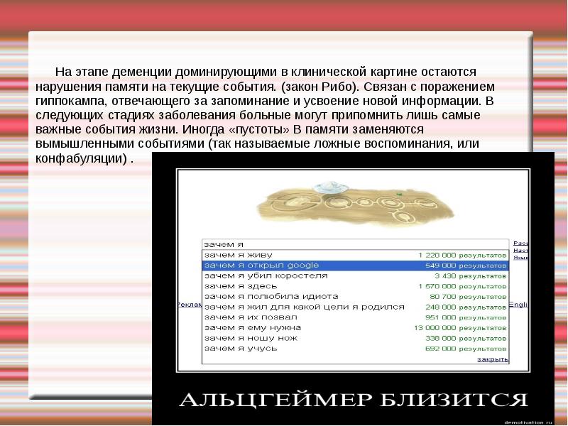 Болезнь Альцгеймера закон Рибо. Нарушение памяти по закону Рибо. Шутки про деменцию. Деменция юмор.