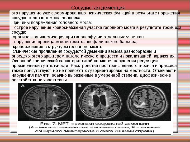 Резидуальные изменения головного. Деменция на мрт головного мозга. Сосудистая деменция мрт. Мрт головного мозга при сосудистой деменции. Сосудистая энцефалопатия головного мозга что это такое.