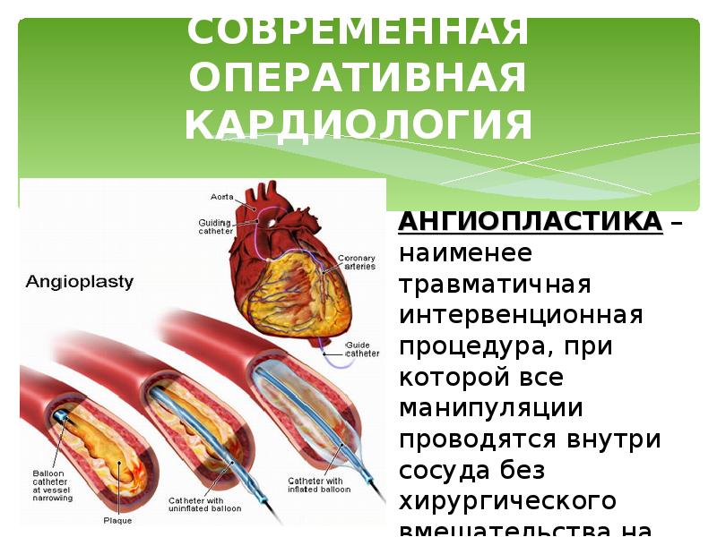 Стол при сердечно сосудистых заболеваниях