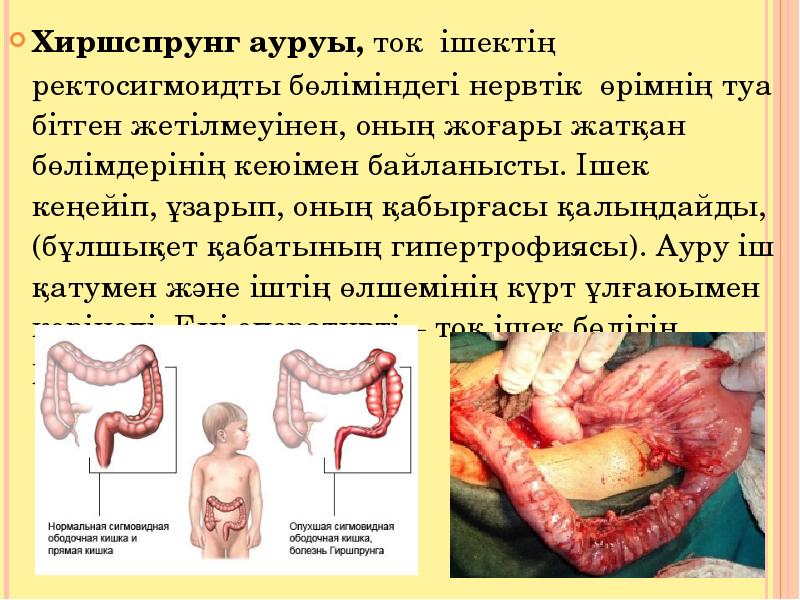 Кеуде жарақаттары презентация