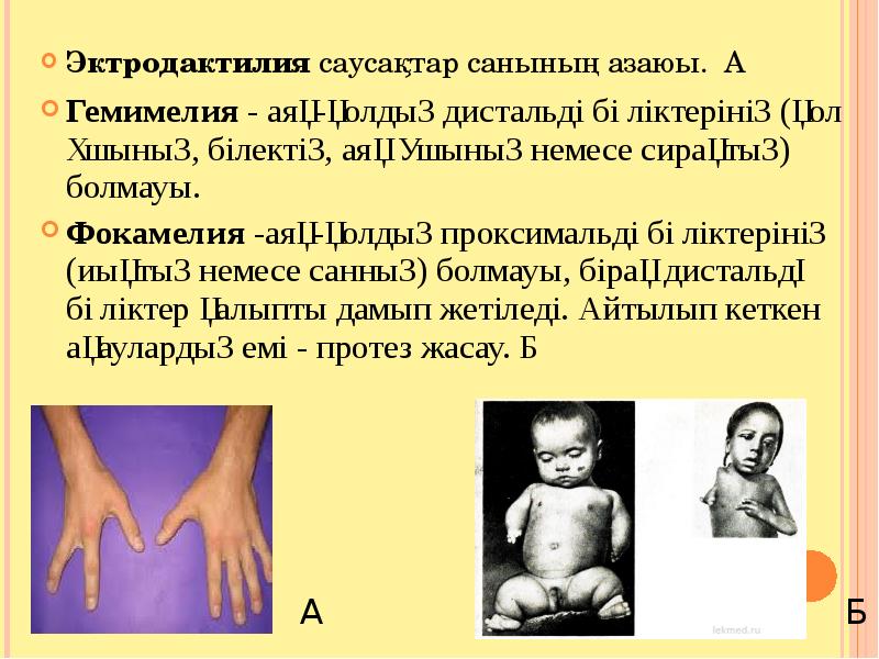 Кеуде жарақаттары презентация