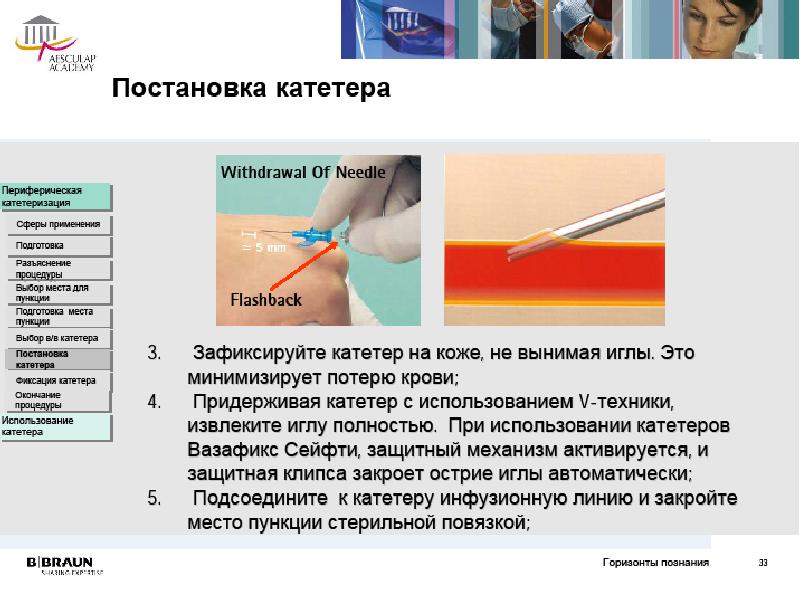 Катетеризация используется для. Введение лекарственных средств через катетер. Использованный катетер необходимо. Способ(ы) голосования катетерный.