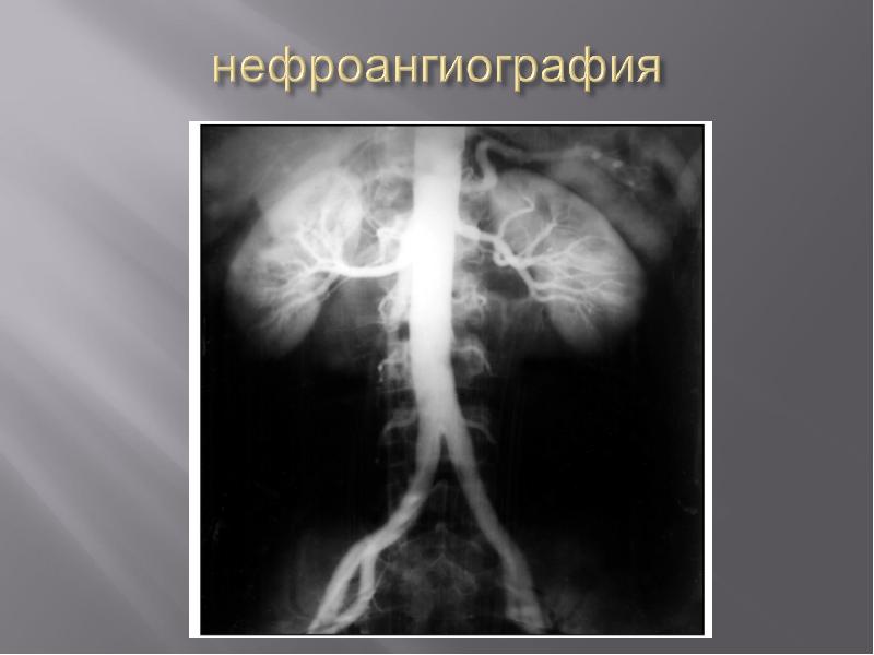 Лучевая диагностика нервной системы презентация