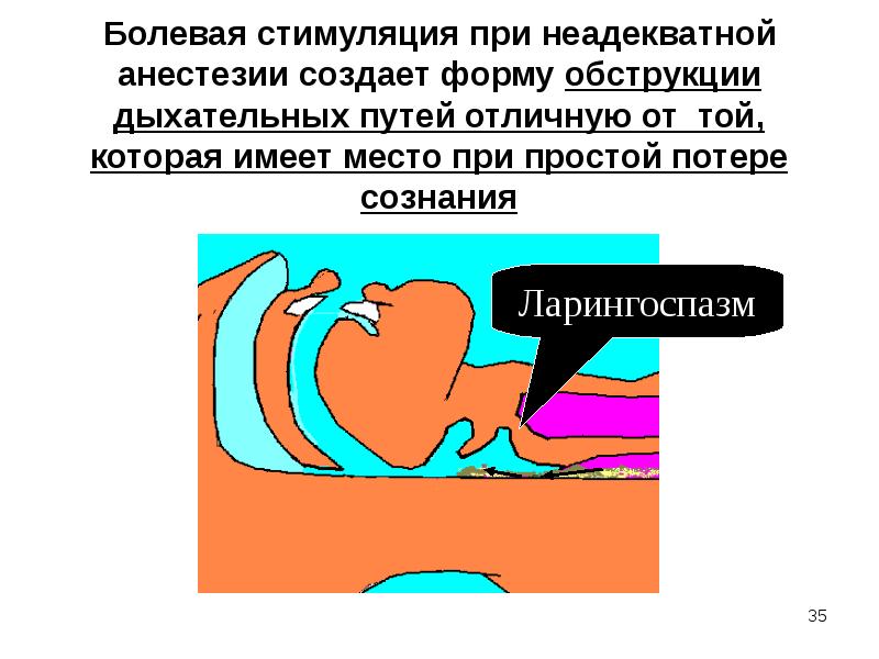 Болевая стимуляция при неадекватной анестезии создает форму обструкции дыхательных путей отличную Болевая стимуляция при неадекватной анестезии создает форму обструкции дыхательных путей отличную