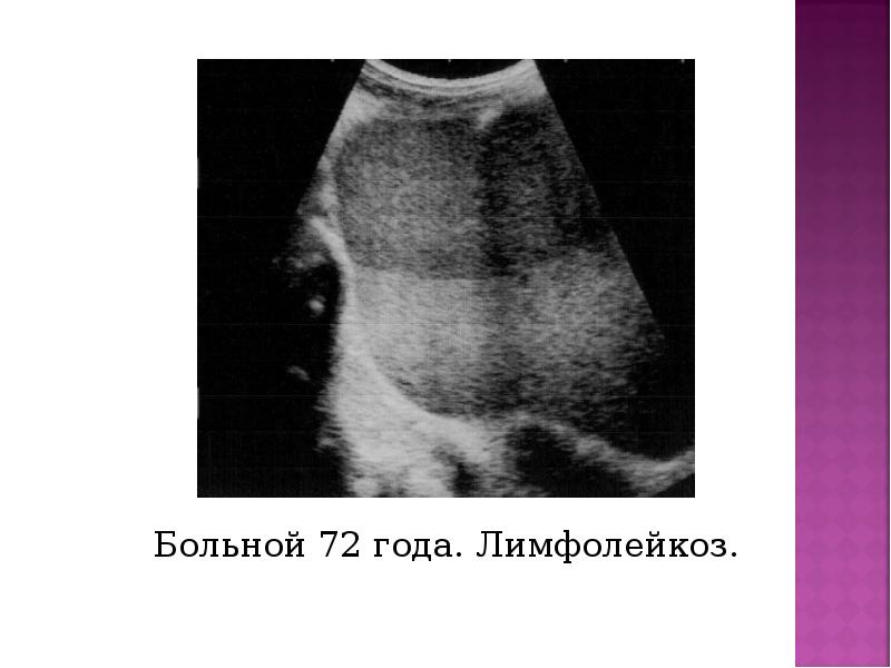 Ультразвуковая терапия презентация