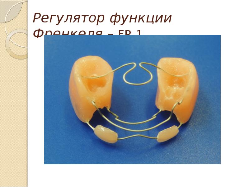 Ортодонтические аппараты комбинированного действия презентация